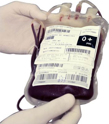 image picture risks of blood transfusion